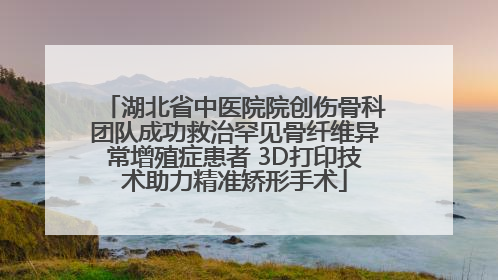 湖北省中医院院创伤骨科团队成功救治罕见骨纤维异常增殖症患者 3D打印技术助力精准矫形手术